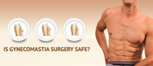 https://gynecomastiasurgery.co/is-it-worth-getting-gynecomastia-surgery/ Is it worth getting gynecomastia surgery? The decision to undergo gynecomastia surgery is a personal one and depends on various factors, including the severity of the condition, its impact on your physical and emotional well-being, and your personal goals and preferences. While I cannot make a specific recommendation for you, I can provide you with some information to consider when making this decision.